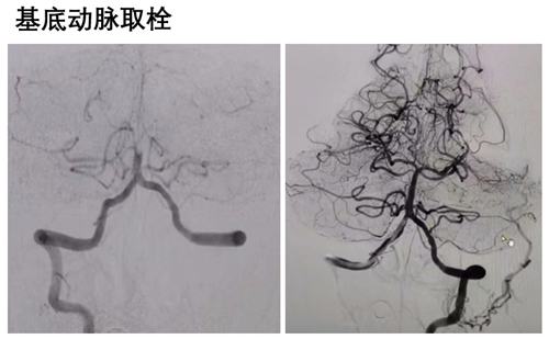 90bb1bbff580ecd218fb361ab7fb38c8_20240808144732986.png 90bb1bbff580ecd218fb361ab7fb38c8_20240808144732986.png